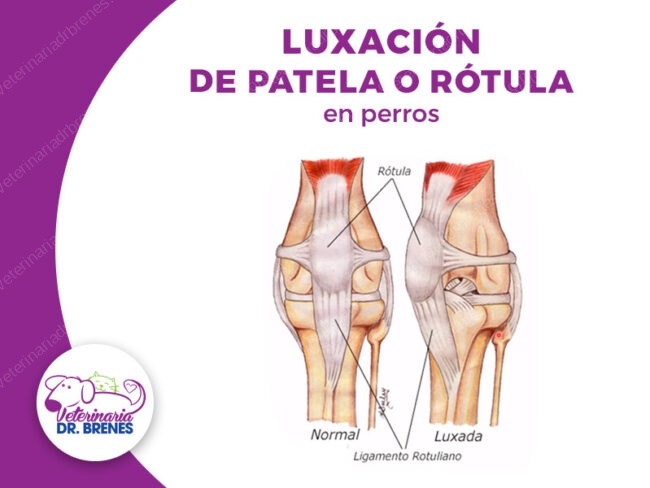 luxacion-patela-google